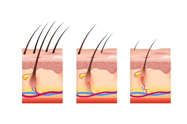skin layers with different numbers of hairs
